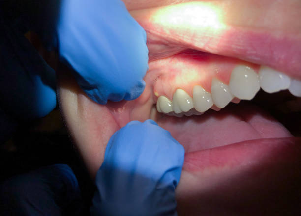 Best Weekend Emergency Dentist in East Dundee, IL